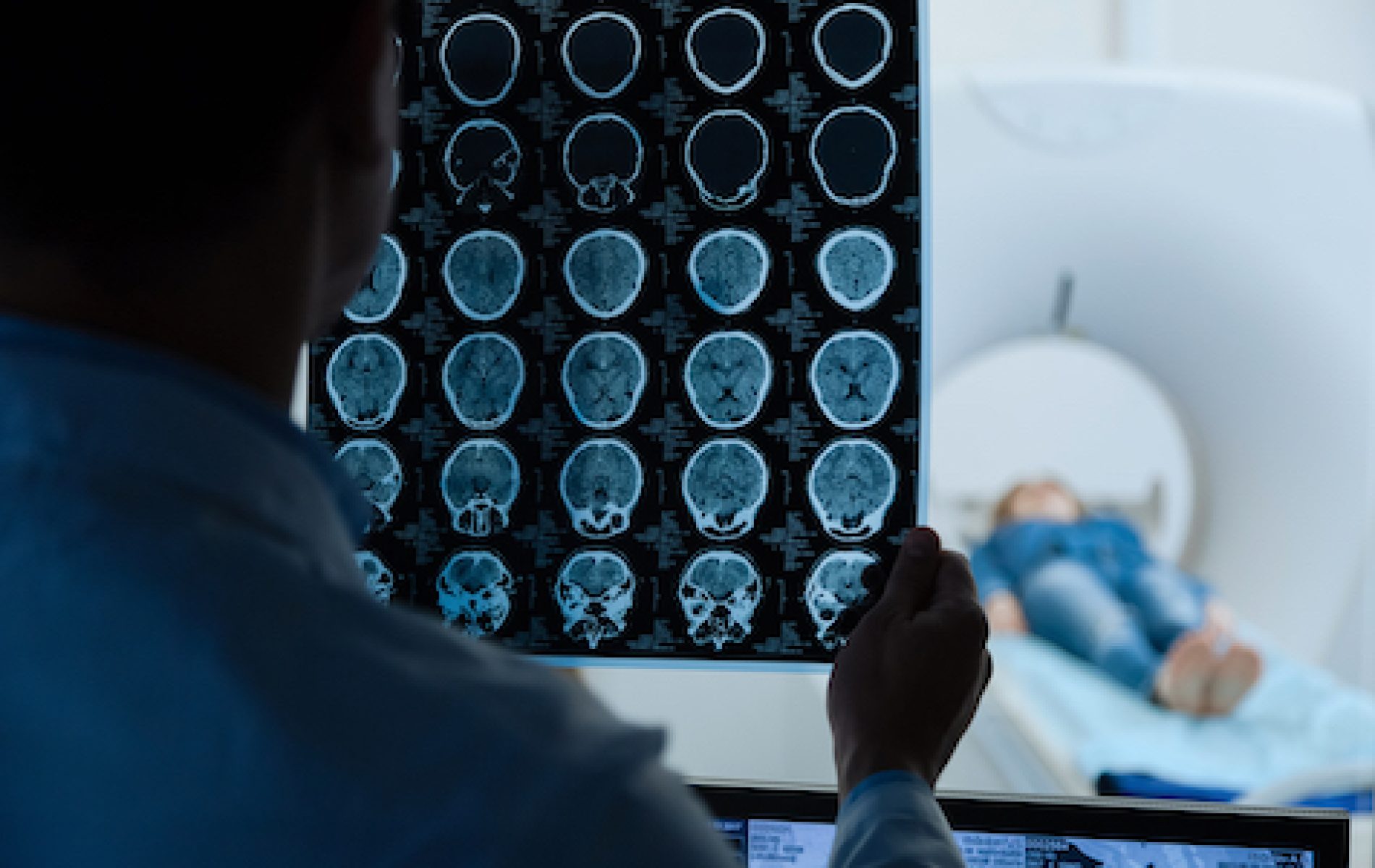 Brain pathology. Close up of MRI scan images being examined by a professional male doctor while doing a medical research