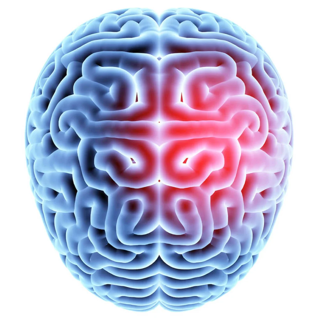 concussion treatment programs