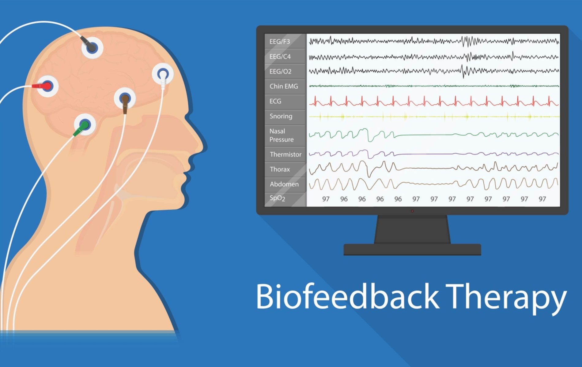 neurofeedback for depression