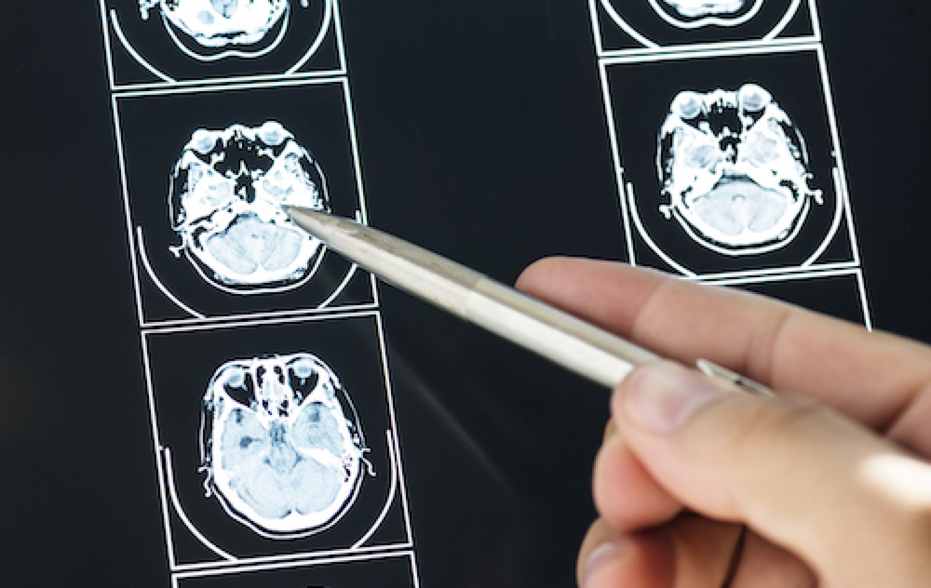 A person is holding a metal tip in front of a picture of a head.