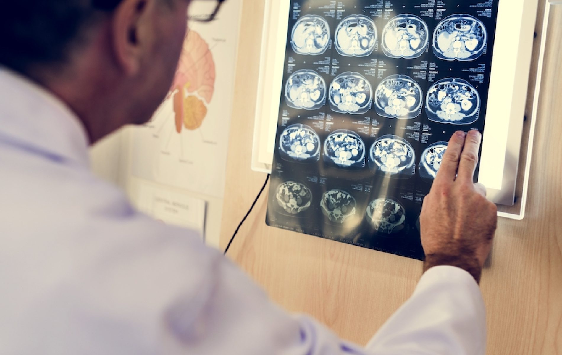 Doctor checking x-ray results
